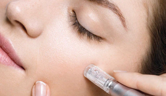 Microneedling