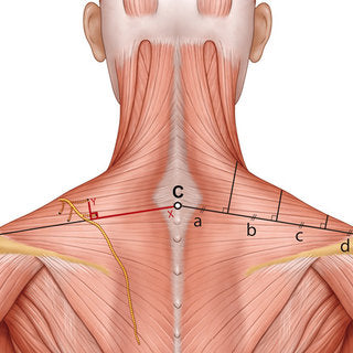 Trapezius toxin masterclass