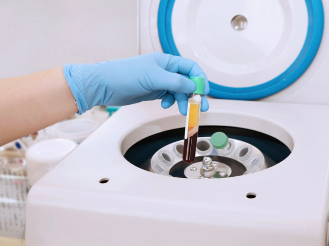 Platelet Rich Plasma Training (PRP)