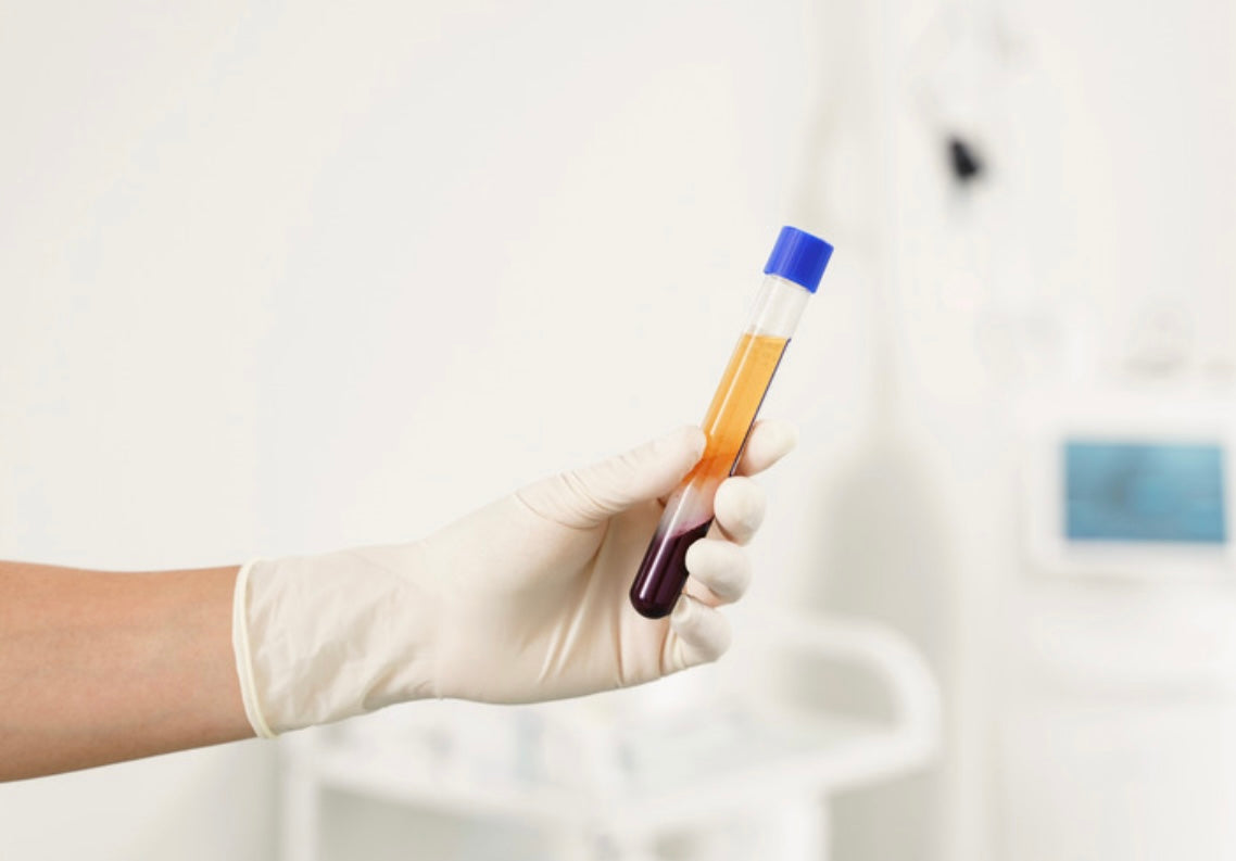 Platelet Rich Plasma Training (PRP)